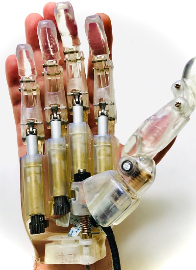 low cost prosthesis hand  bionic hand 3D printing 電動義手 筋電義手